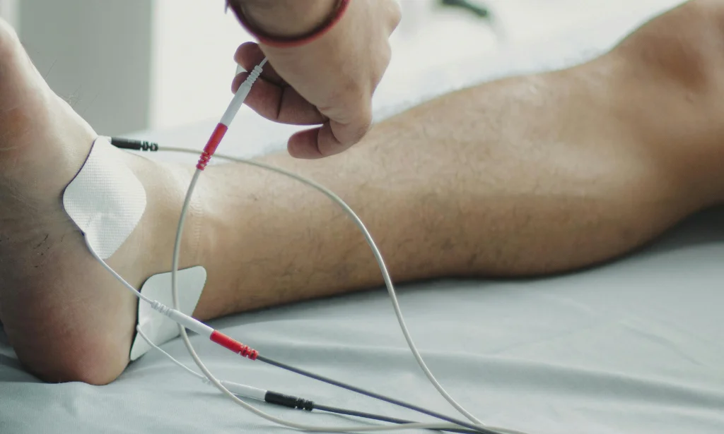 fisioterapia invasiva