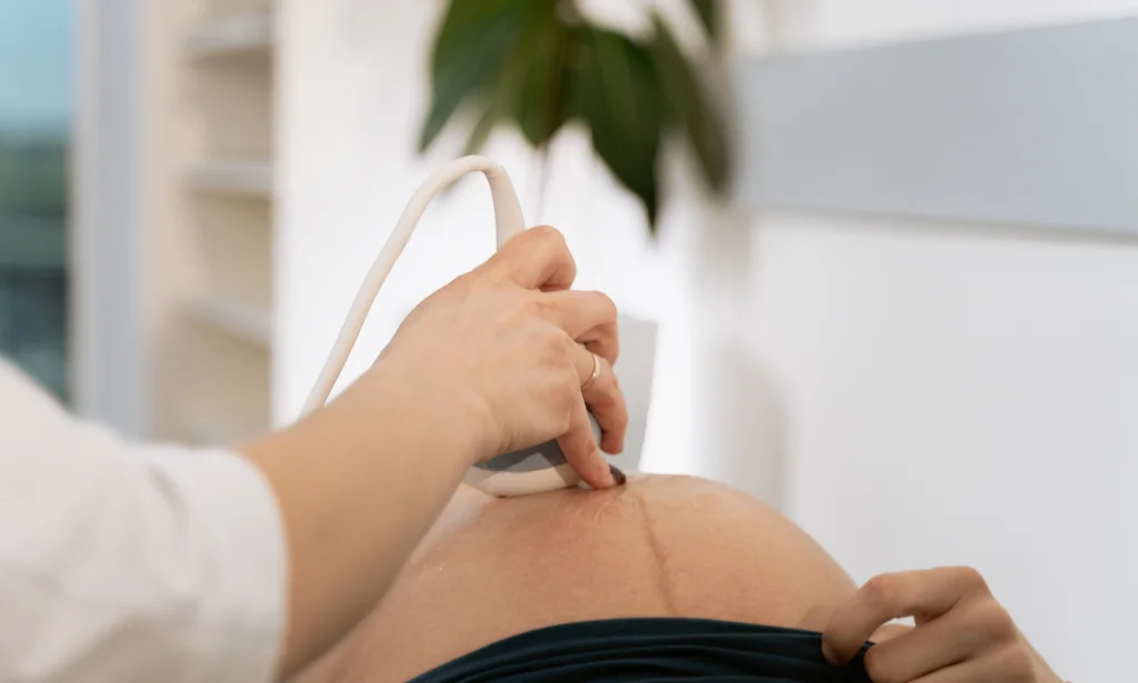 diástasis abdominal